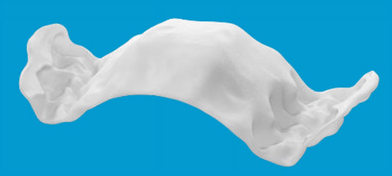 インビザライン